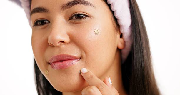 Pimple Patches 101: Hydrocolloid, Microdot, and Everything Between